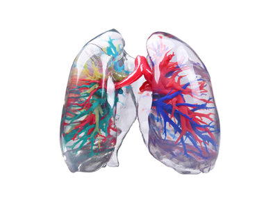 3D打印肺部模型.png